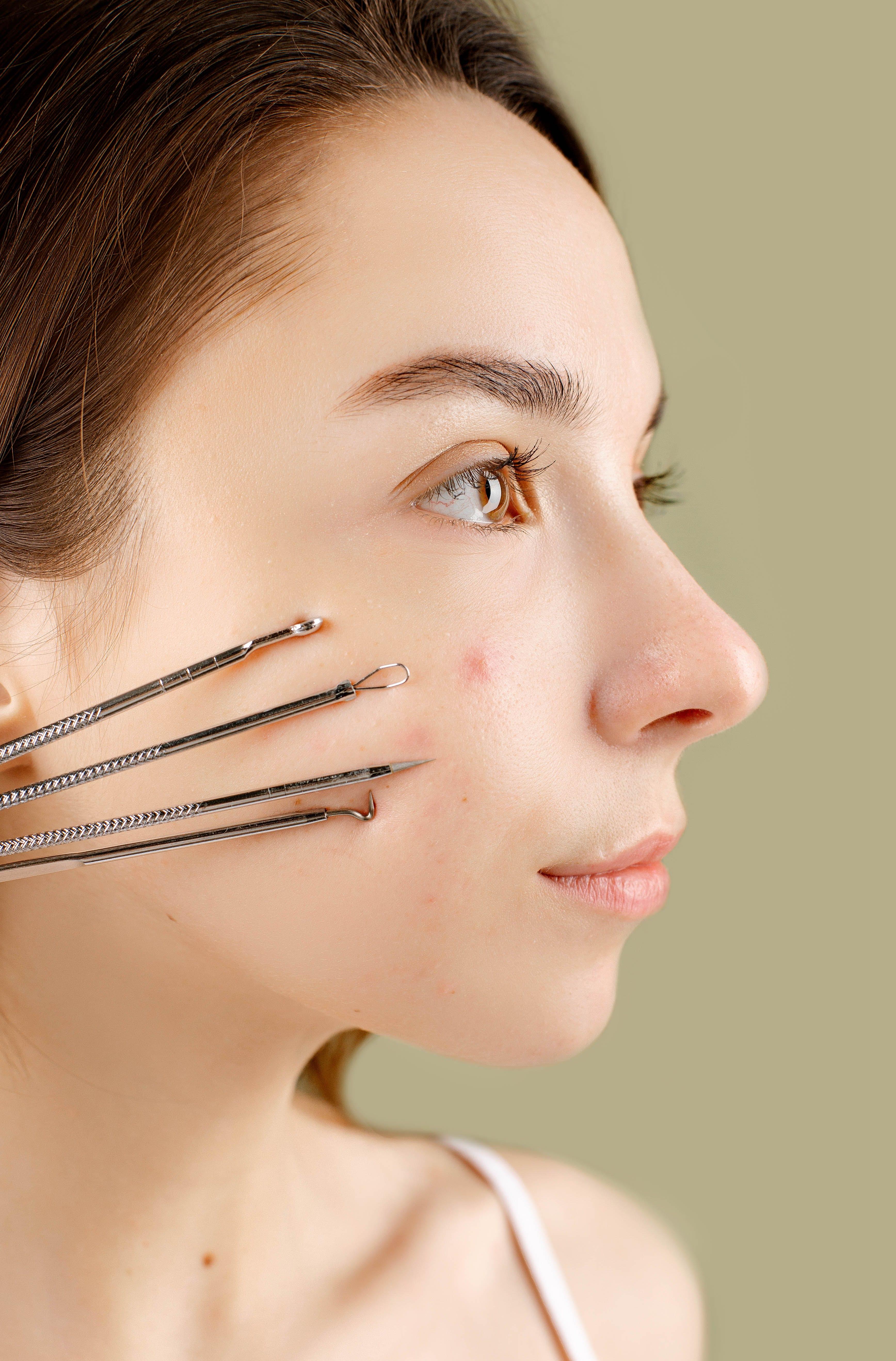 Trusa cosmetica profesionala pentru extractie puncte negre, comedoane, acnee, ustensile cosmetice din inox, 9 piese, onuvio® - roz