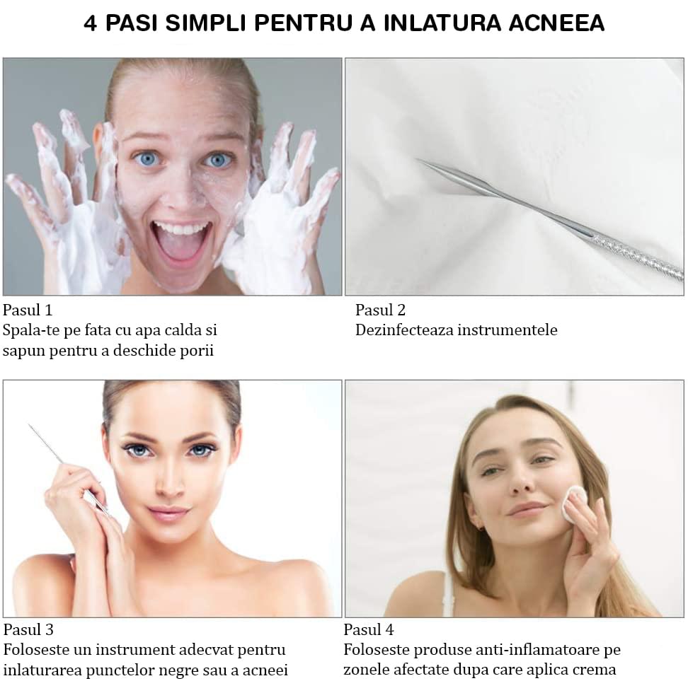 Trusa cosmetica profesionala pentru extractie puncte negre, comedoane, acnee, ustensile cosmetice din inox, 9 piese, onuvio®